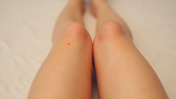 Épilation laser des jambes : ce que vous devez savoir pour des résultats optimaux